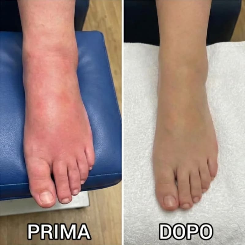 Stop a dolore e gonfiore